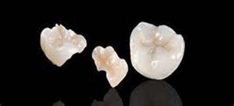 Dental Arts Laboratories Premise Indirect™
