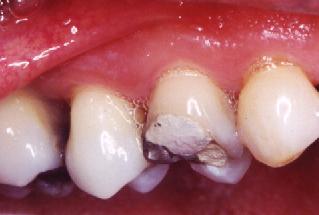 bcusp.JPG (9948 bytes)